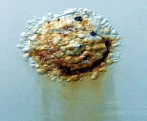 Chlor Rid Removedor de sais solúveis